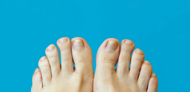 Foot & Nail Care